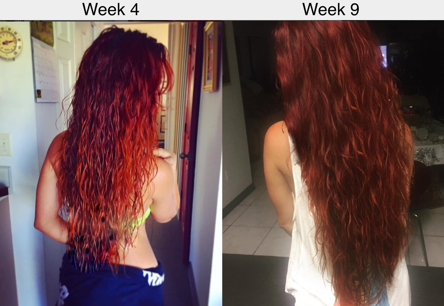 Grow Hair Faster: 6-Day Speed Up Method | Champïone