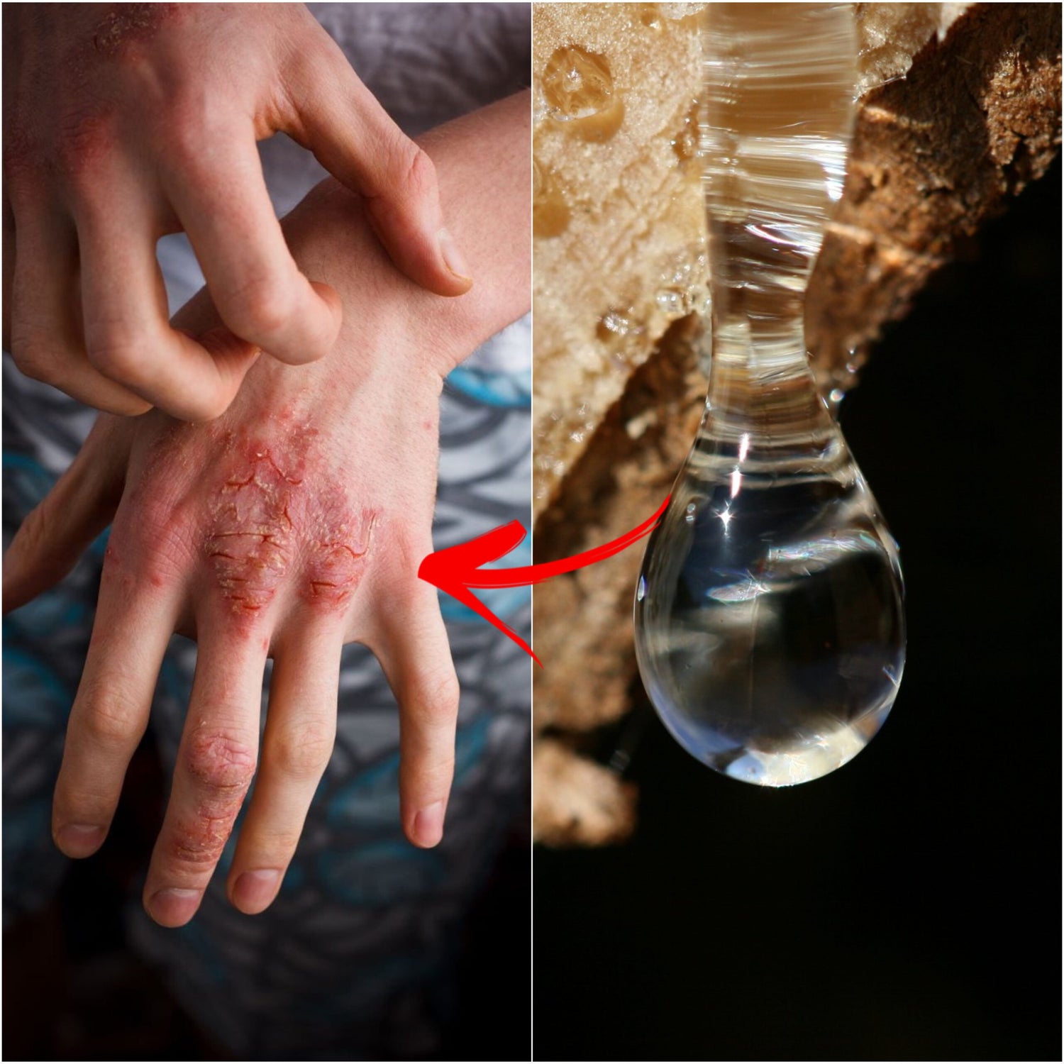 Tree Resins for Skin Healing: Medical Insights