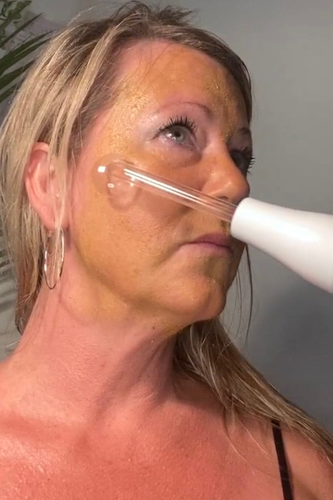 Skin Face Mask, Clear Skin Face Mask - Acne Fighting